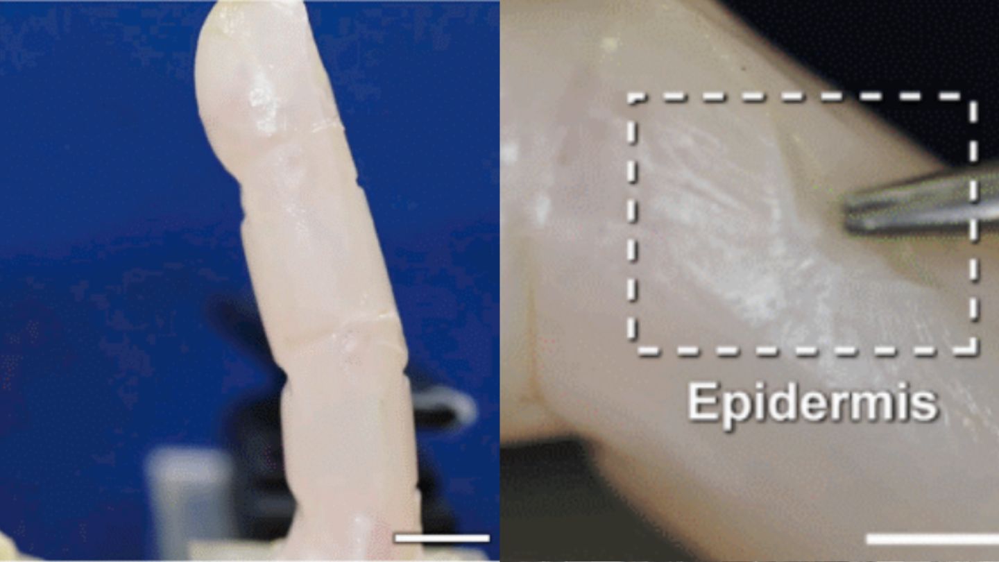 Scientists Grew Living Human Skin That Self-Heals on a Robot Finger